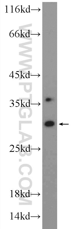 Western Blot (WB) analysis of SW 1990 cells using TIP30 Polyclonal antibody (10251-1-AP)