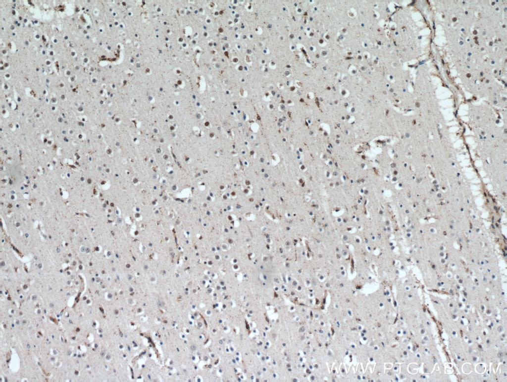 Immunohistochemistry (IHC) staining of human brain tissue using HTATSF1 Polyclonal antibody (20805-1-AP)