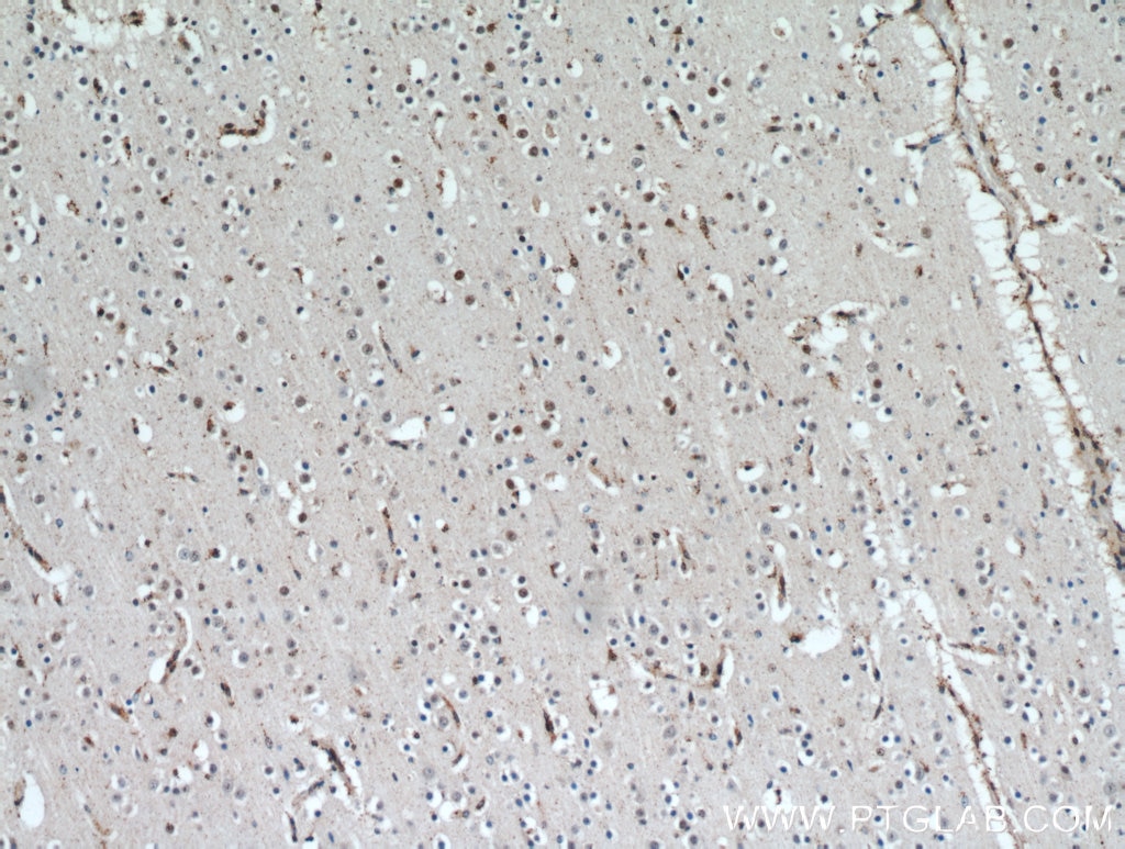 IHC staining of human brain using 20805-1-AP