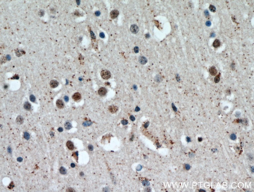 IHC staining of human brain using 20805-1-AP