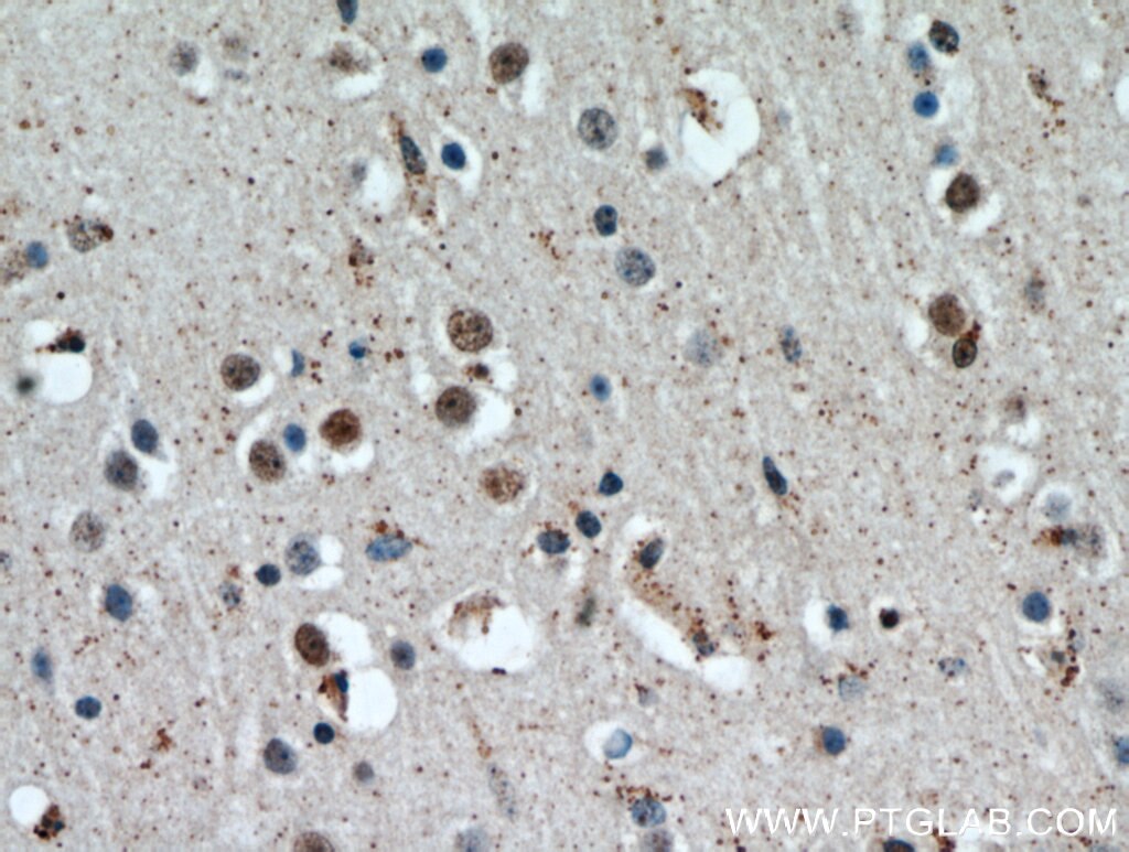 Immunohistochemistry (IHC) staining of human brain tissue using HTATSF1 Polyclonal antibody (20805-1-AP)