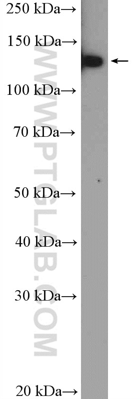 Western Blot (WB) analysis of HeLa cells using HTATSF1 Polyclonal antibody (20805-1-AP)