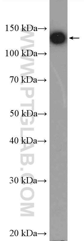 Western Blot (WB) analysis of HepG2 cells using HTATSF1 Polyclonal antibody (20805-1-AP)