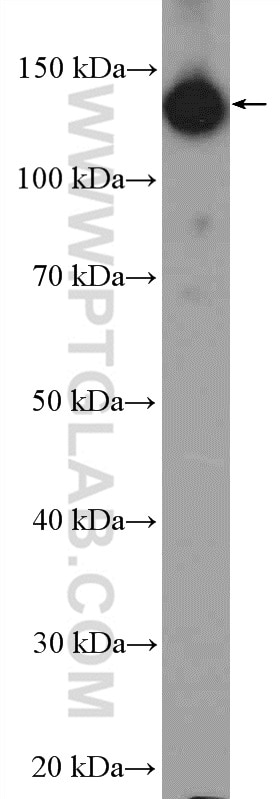 Western Blot (WB) analysis of Jurkat cells using HTATSF1 Polyclonal antibody (20805-1-AP)