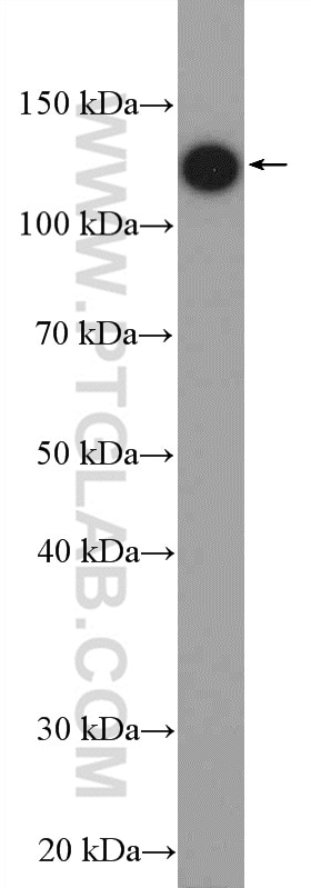 Western Blot (WB) analysis of HeLa cells using HTATSF1 Polyclonal antibody (20805-1-AP)