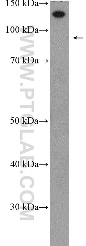 Western Blot (WB) analysis of rat brain tissue using HTATSF1 Polyclonal antibody (20805-1-AP)