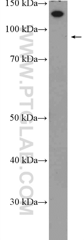 WB analysis of rat brain using 20805-1-AP