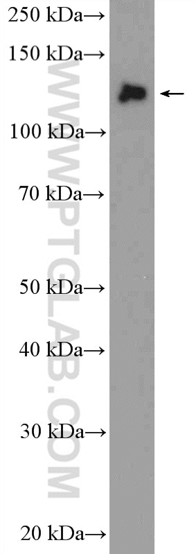 Western Blot (WB) analysis of mouse brain tissue using HTATSF1 Polyclonal antibody (20805-1-AP)