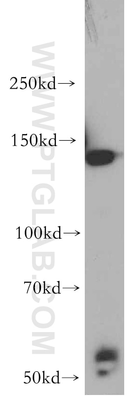 Western Blot (WB) analysis of HepG2 cells using HTATSF1 Polyclonal antibody (20805-1-AP)