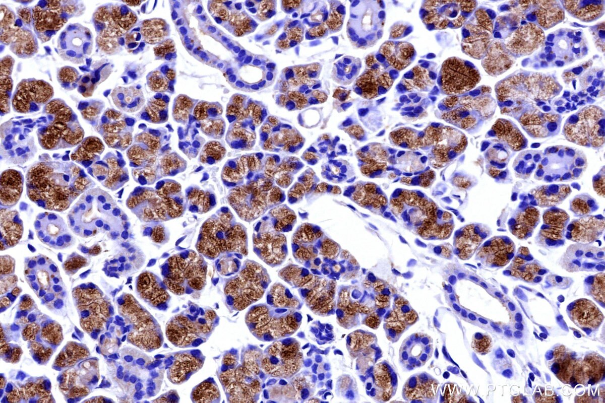 IHC staining of mouse salivary gland using 16261-1-AP Immunohistochemistry (IHC) staining of mouse salivary gland tissue using HTN3 Polyclonal antibody (16261-1-AP)