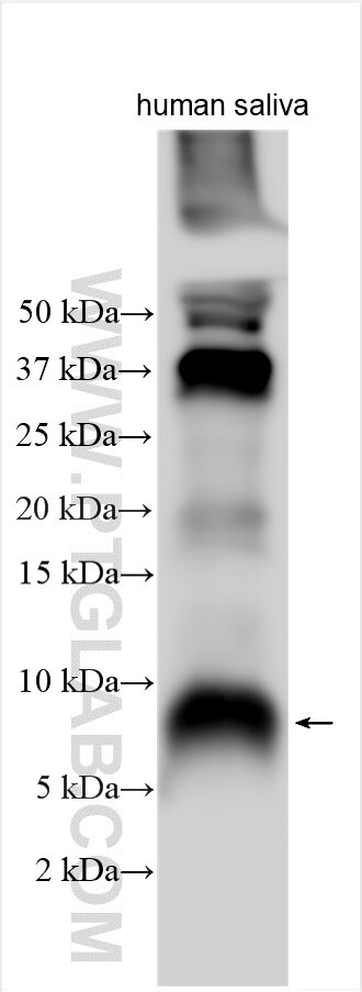 Western Blot (WB) analysis of various lysates using HTN3 Polyclonal antibody (16261-1-AP)