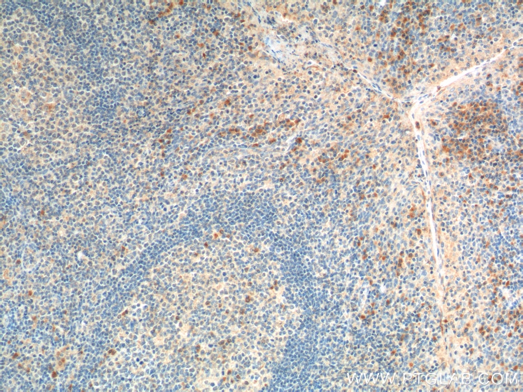 Immunohistochemistry (IHC) staining of human tonsillitis tissue using HTR1A Polyclonal antibody (55302-1-AP)