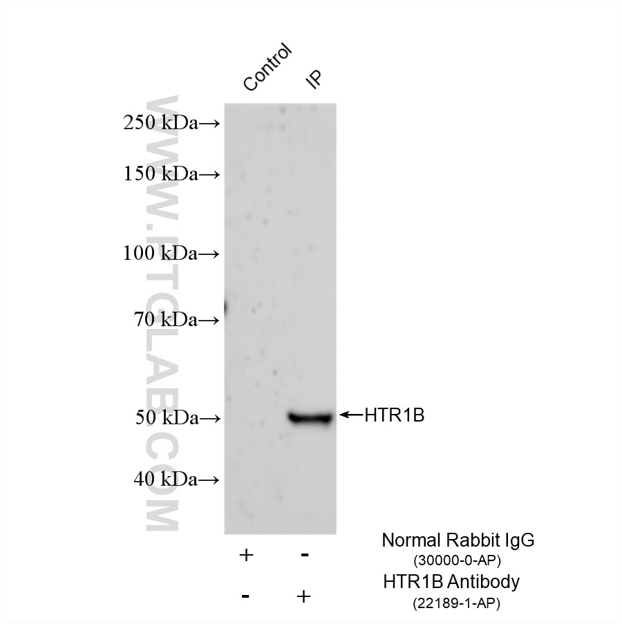 IP experiment of mouse placenta using 22189-1-AP Immunoprecipitation (IP) experiment of mouse placenta tissue using HTR1B Polyclonal antibody (22189-1-AP)