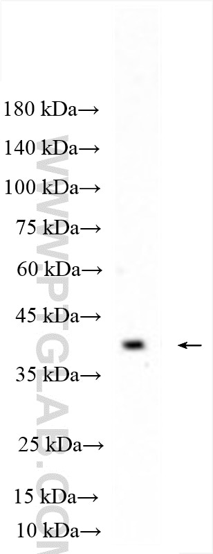 Western Blot (WB) analysis of human placenta tissue using HTR1B Polyclonal antibody (22189-1-AP)