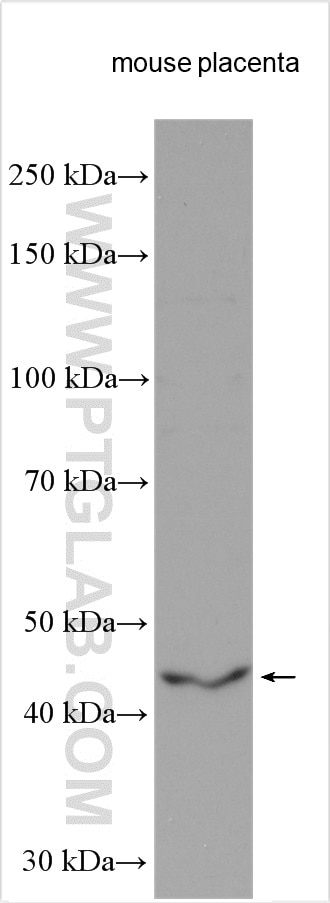 Western Blot (WB) analysis of mouse placenta tissue using HTR1B Polyclonal antibody (22189-1-AP)