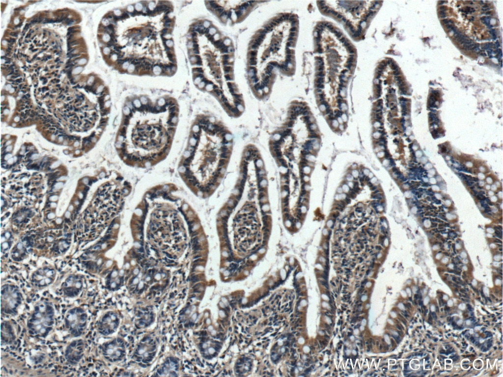 IHC staining of human small intestine using 26438-1-AP