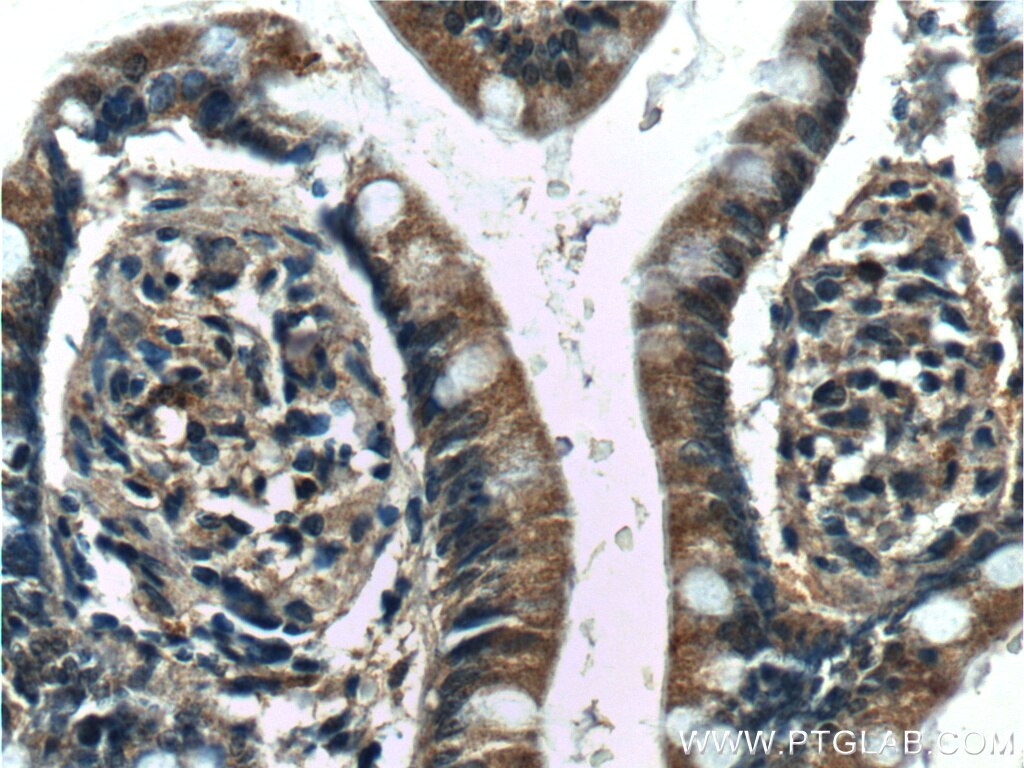 Immunohistochemistry (IHC) staining of human small intestine tissue using 5HT2A Receptor Polyclonal antibody (26438-1-AP)