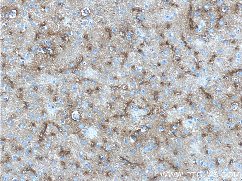 Immunohistochemistry (IHC) staining of human brain tissue using 5HT2A Receptor Polyclonal antibody (26438-1-AP)