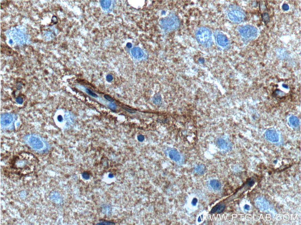 Immunohistochemistry (IHC) staining of human brain tissue using 5HT2A Receptor Polyclonal antibody (26438-1-AP)