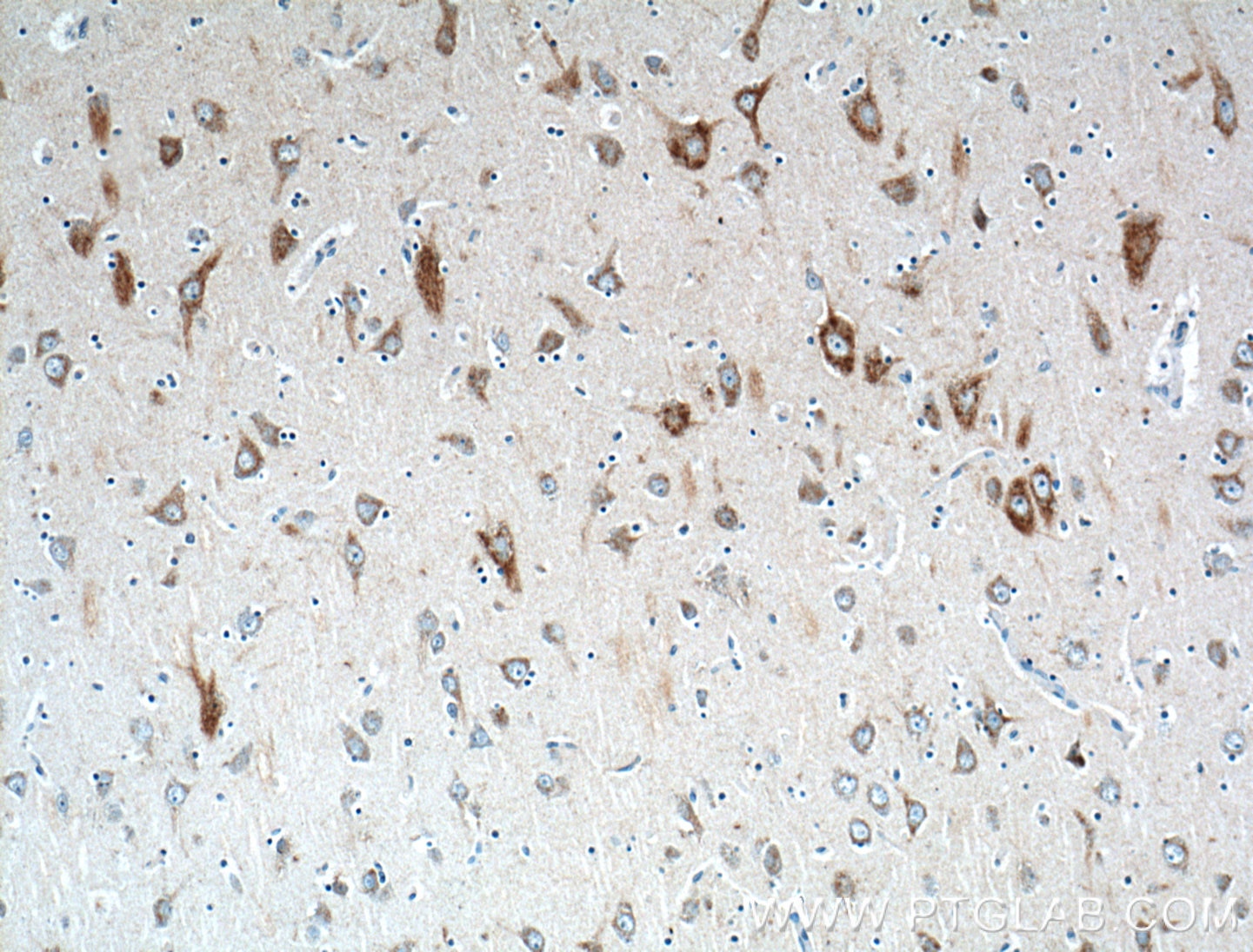 Immunohistochemistry (IHC) staining of human brain tissue using HTR2B Polyclonal antibody (26408-1-AP)