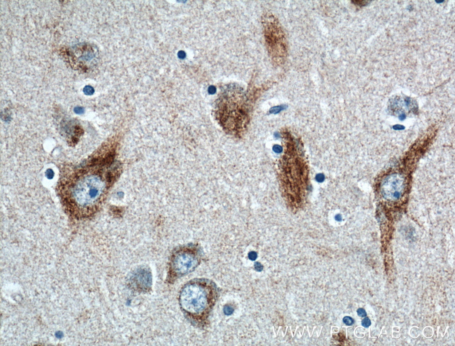 Immunohistochemistry (IHC) staining of human brain tissue using HTR2B Polyclonal antibody (26408-1-AP)