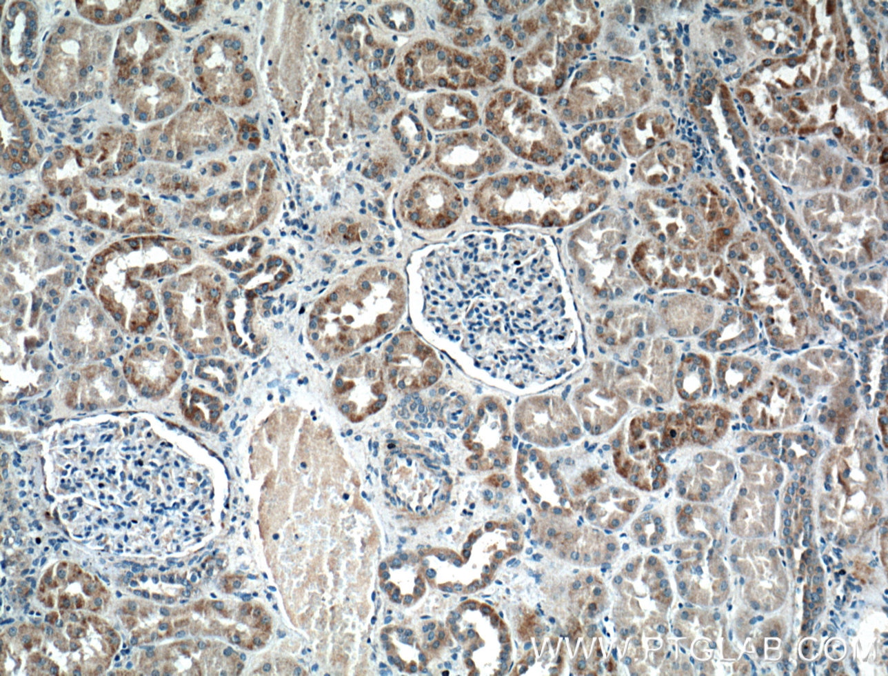 Immunohistochemistry (IHC) staining of human kidney tissue using HTR2B Polyclonal antibody (26408-1-AP)