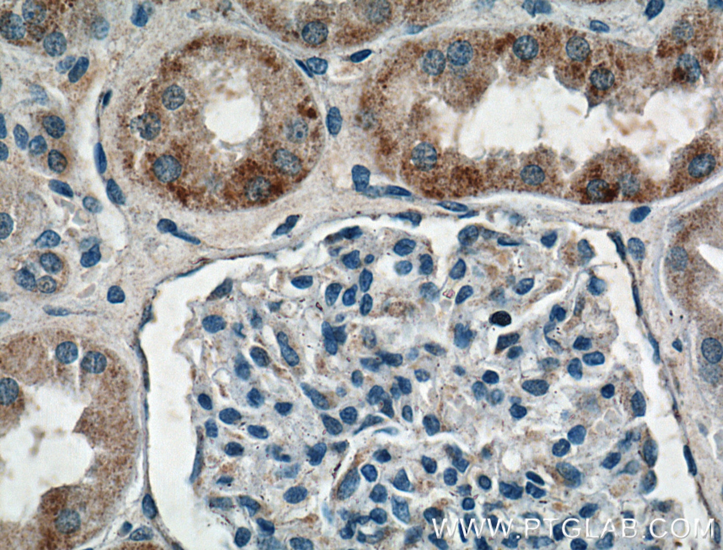 Immunohistochemistry (IHC) staining of human kidney tissue using HTR2B Polyclonal antibody (26408-1-AP)