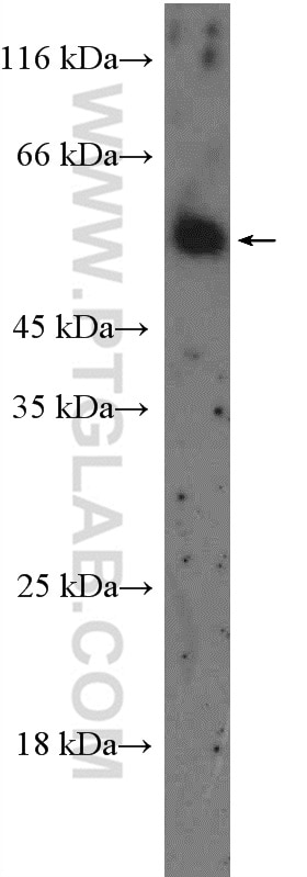 Western Blot (WB) analysis of mouse brain tissue using HTR2B Polyclonal antibody (26408-1-AP)