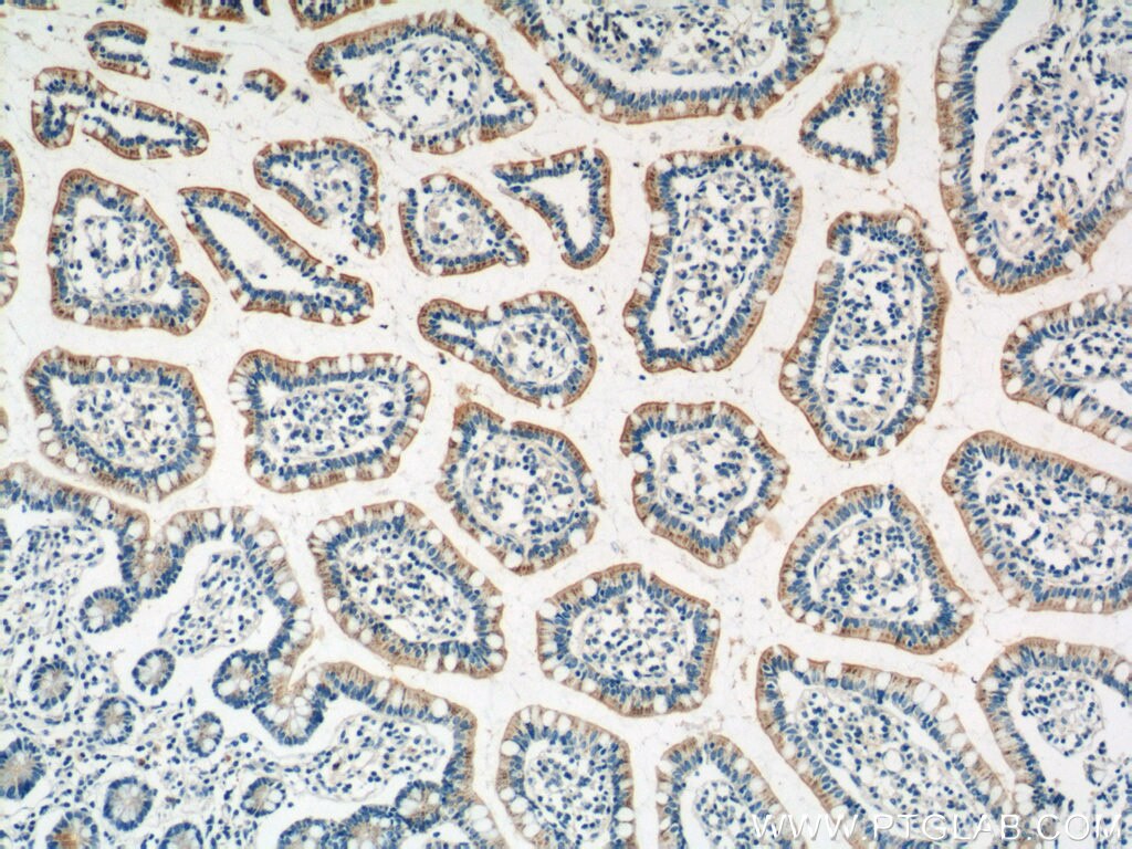 Immunohistochemistry (IHC) staining of human small intestine tissue using HTR3A Polyclonal antibody (10443-1-AP)