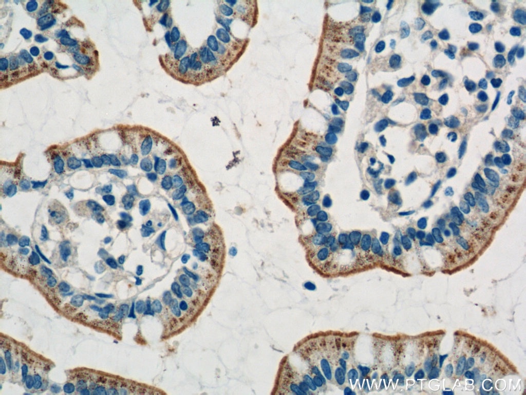 Immunohistochemistry (IHC) staining of human small intestine tissue using HTR3A Polyclonal antibody (10443-1-AP)