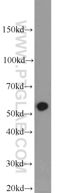 Western Blot (WB) analysis of mouse lung tissue using HTR3A Polyclonal antibody (10443-1-AP)