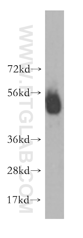 Western Blot (WB) analysis of human brain tissue using HTR3A Polyclonal antibody (10443-1-AP)