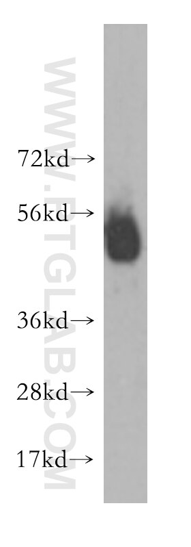 WB analysis of human brain using 10443-1-AP