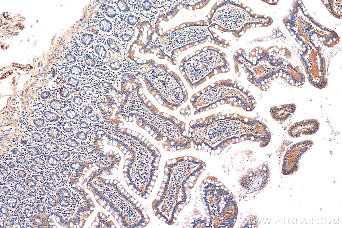 Immunohistochemistry (IHC) staining of human small intestine tissue using HTR3A Polyclonal antibody (29685-1-AP)