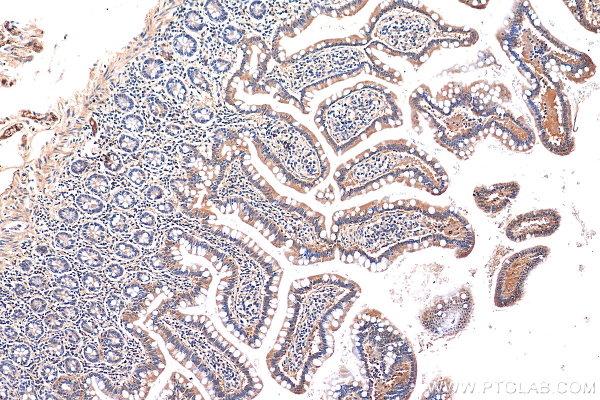 IHC staining of human small intestine using 29685-1-AP