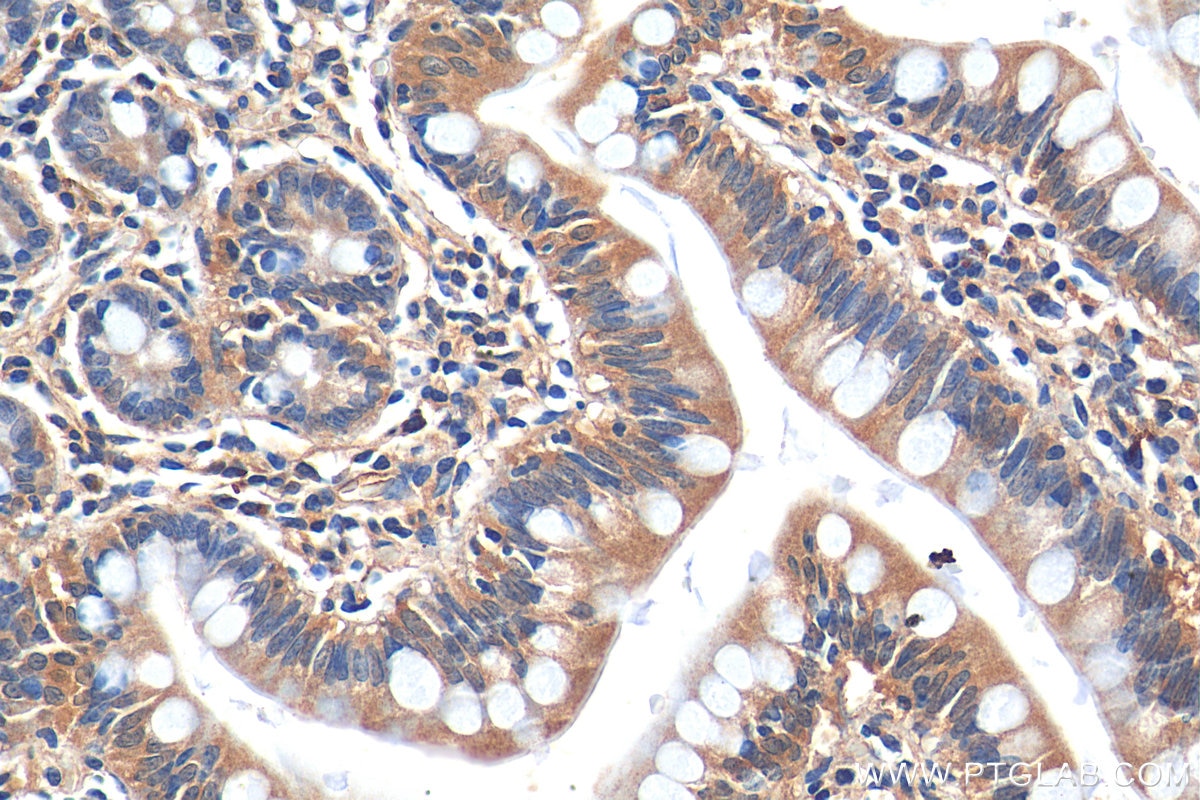 Immunohistochemistry (IHC) staining of human small intestine tissue using HTR3A Polyclonal antibody (29685-1-AP)