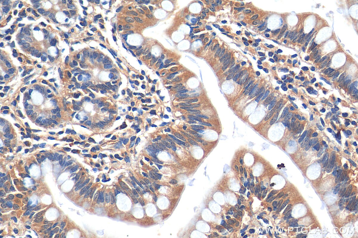 IHC staining of human small intestine using 29685-1-AP