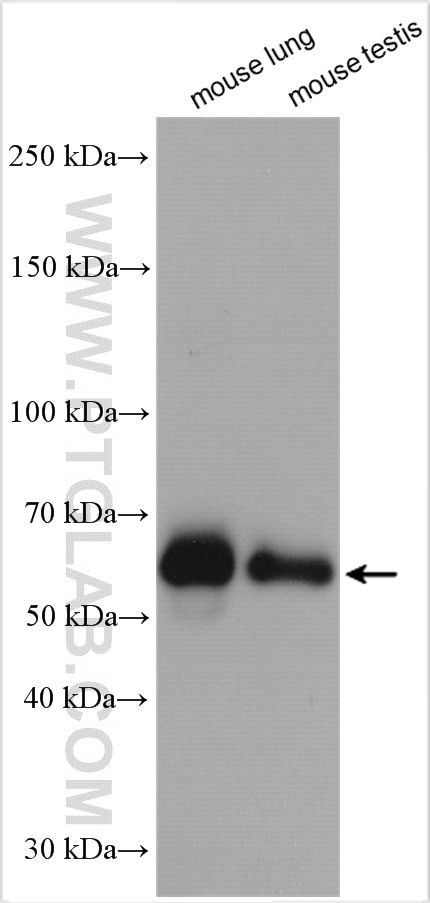 Western Blot (WB) analysis of various lysates using HTR3A Polyclonal antibody (29685-1-AP)