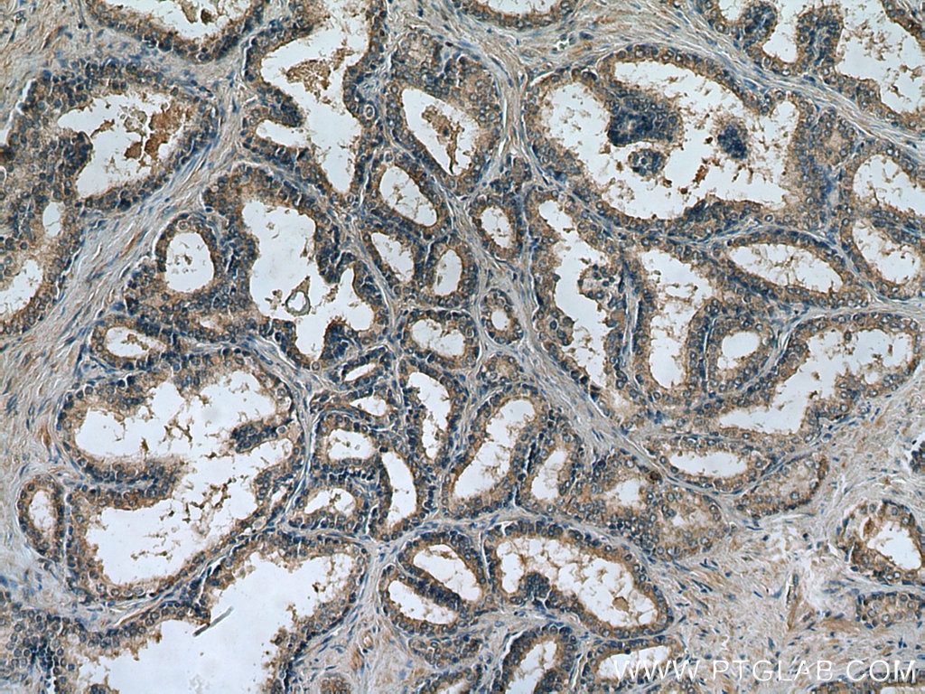Immunohistochemistry (IHC) staining of human prostate hyperplasia tissue using HTR4 Polyclonal antibody (21165-1-AP)