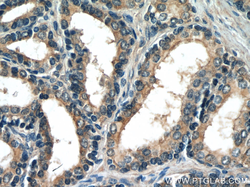 Immunohistochemistry (IHC) staining of human prostate hyperplasia tissue using HTR4 Polyclonal antibody (21165-1-AP)
