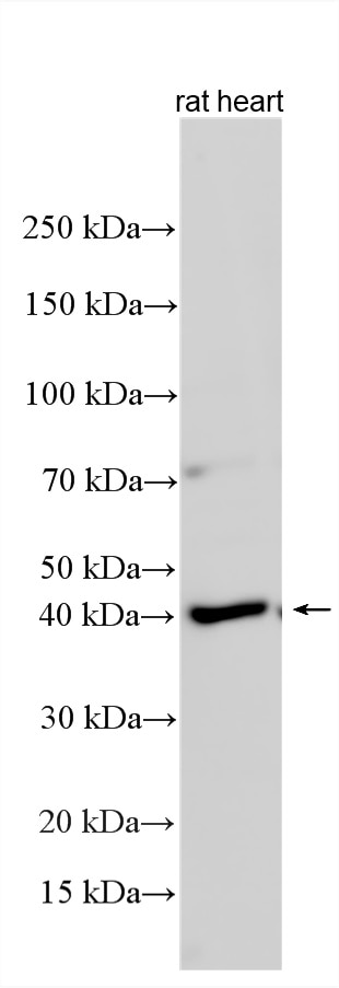 WB analysis using 21165-1-AP Western Blot (WB) analysis of various lysates using HTR4 Polyclonal antibody (21165-1-AP)