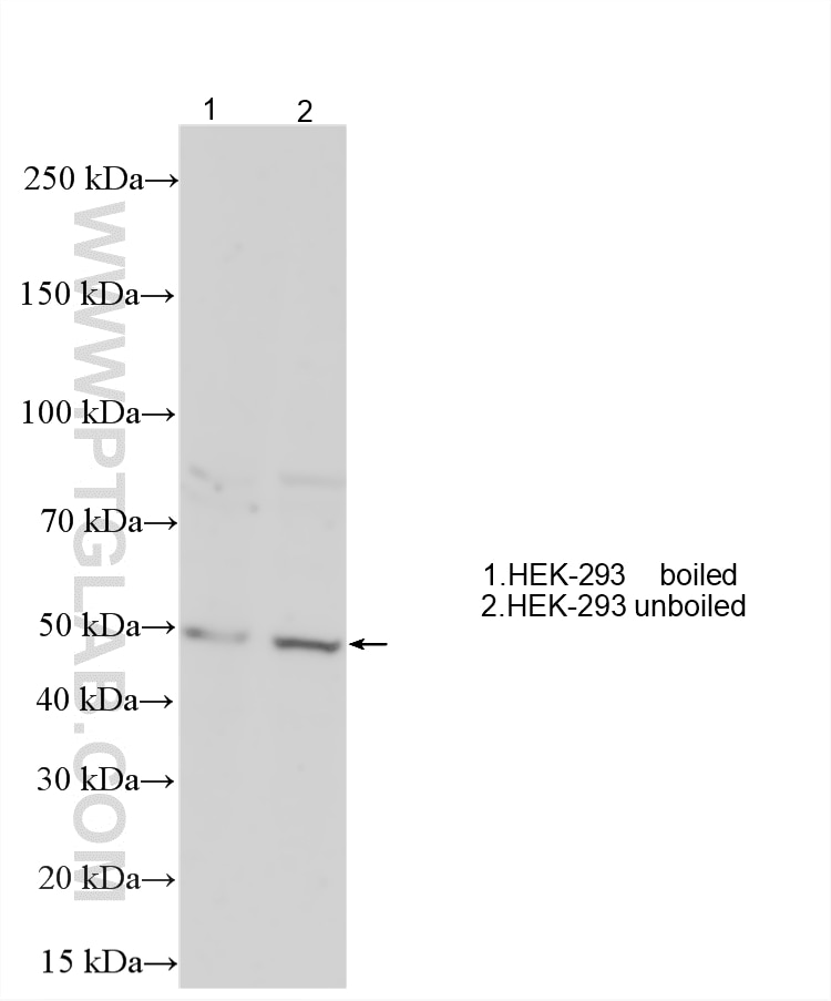 Western Blot (WB) analysis of various lysates using HTR4 Polyclonal antibody (21165-1-AP)