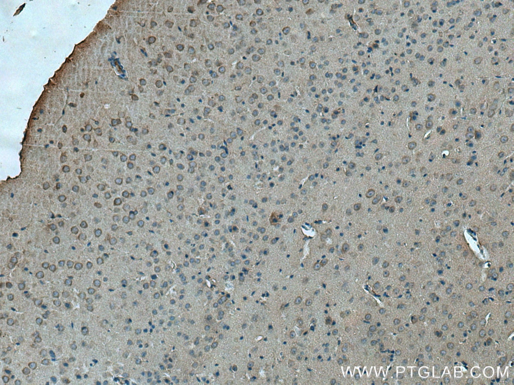 Immunohistochemistry (IHC) staining of mouse brain tissue using HTR5A Polyclonal antibody (28221-1-AP)