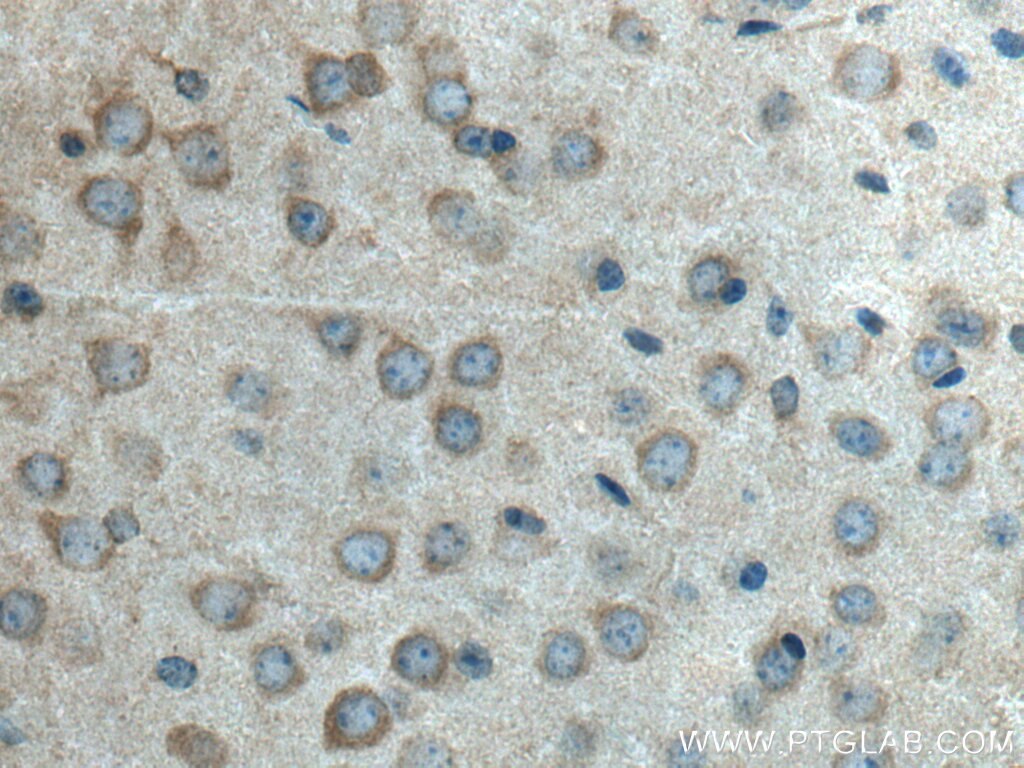 Immunohistochemistry (IHC) staining of mouse brain tissue using HTR5A Polyclonal antibody (28221-1-AP)