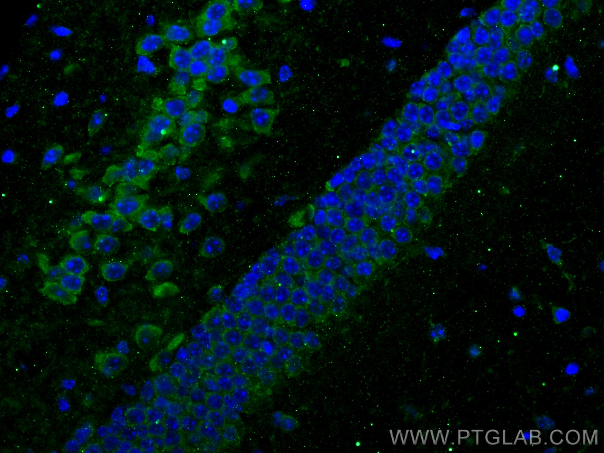 Immunofluorescence (IF) / fluorescent staining of mouse brain tissue using HTR6 Polyclonal antibody (23561-1-AP)