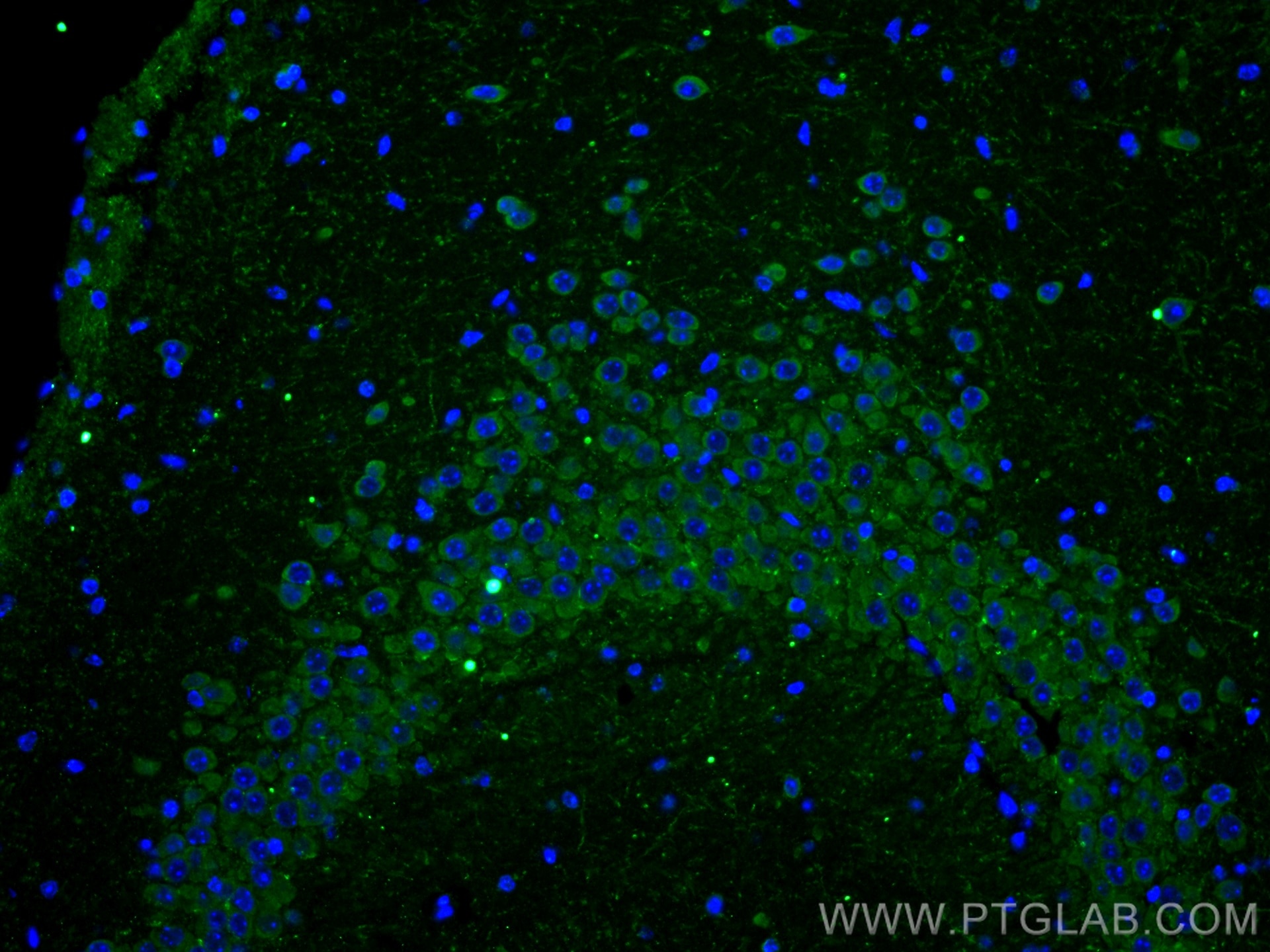 IF Staining of mouse brain using 23561-1-AP