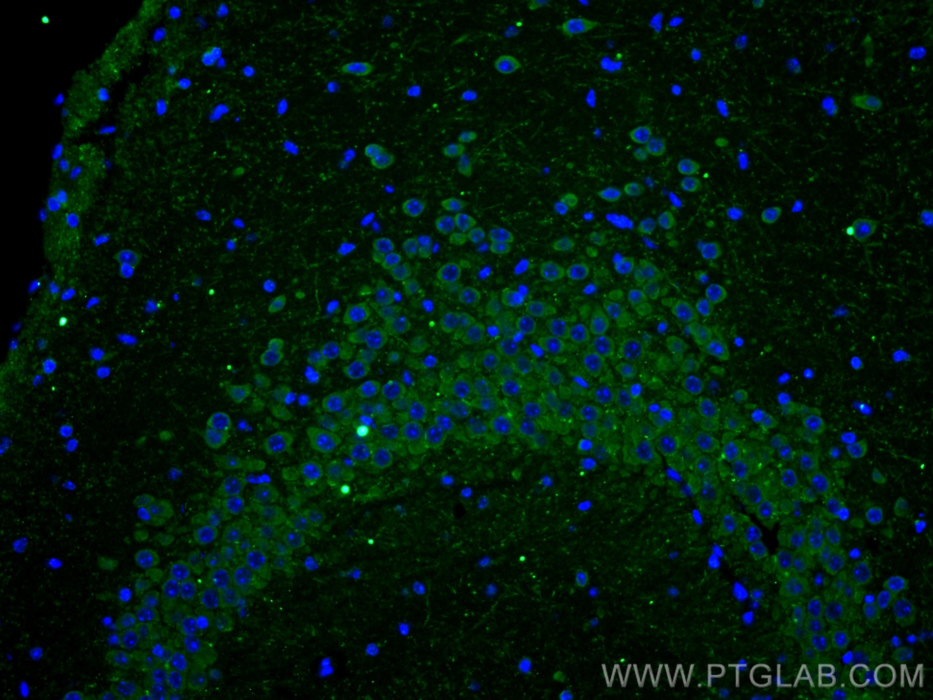 Immunofluorescence (IF) / fluorescent staining of mouse brain tissue using HTR6 Polyclonal antibody (23561-1-AP)