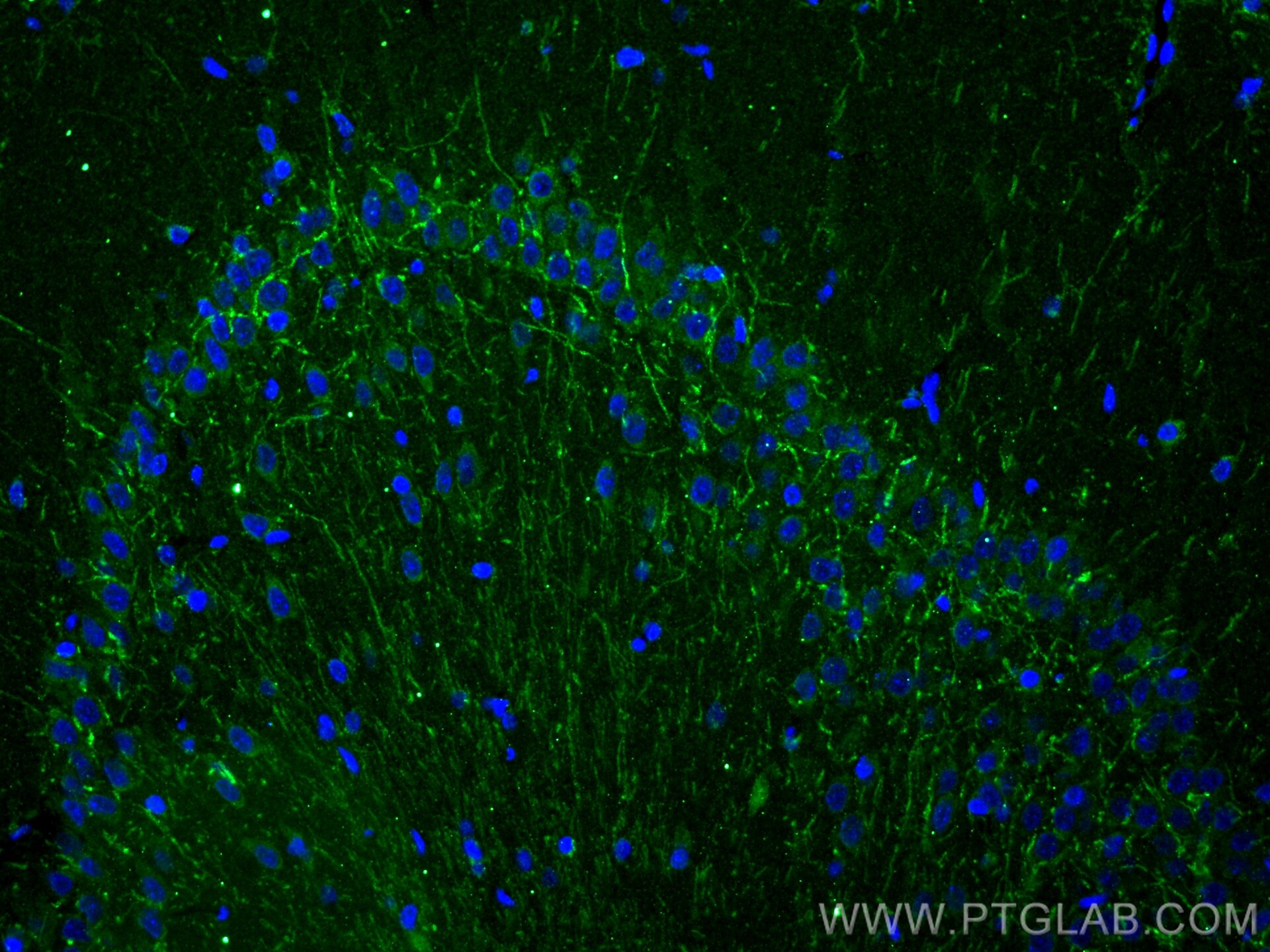 Immunofluorescence (IF) / fluorescent staining of rat brain tissue using HTR6 Polyclonal antibody (23561-1-AP)