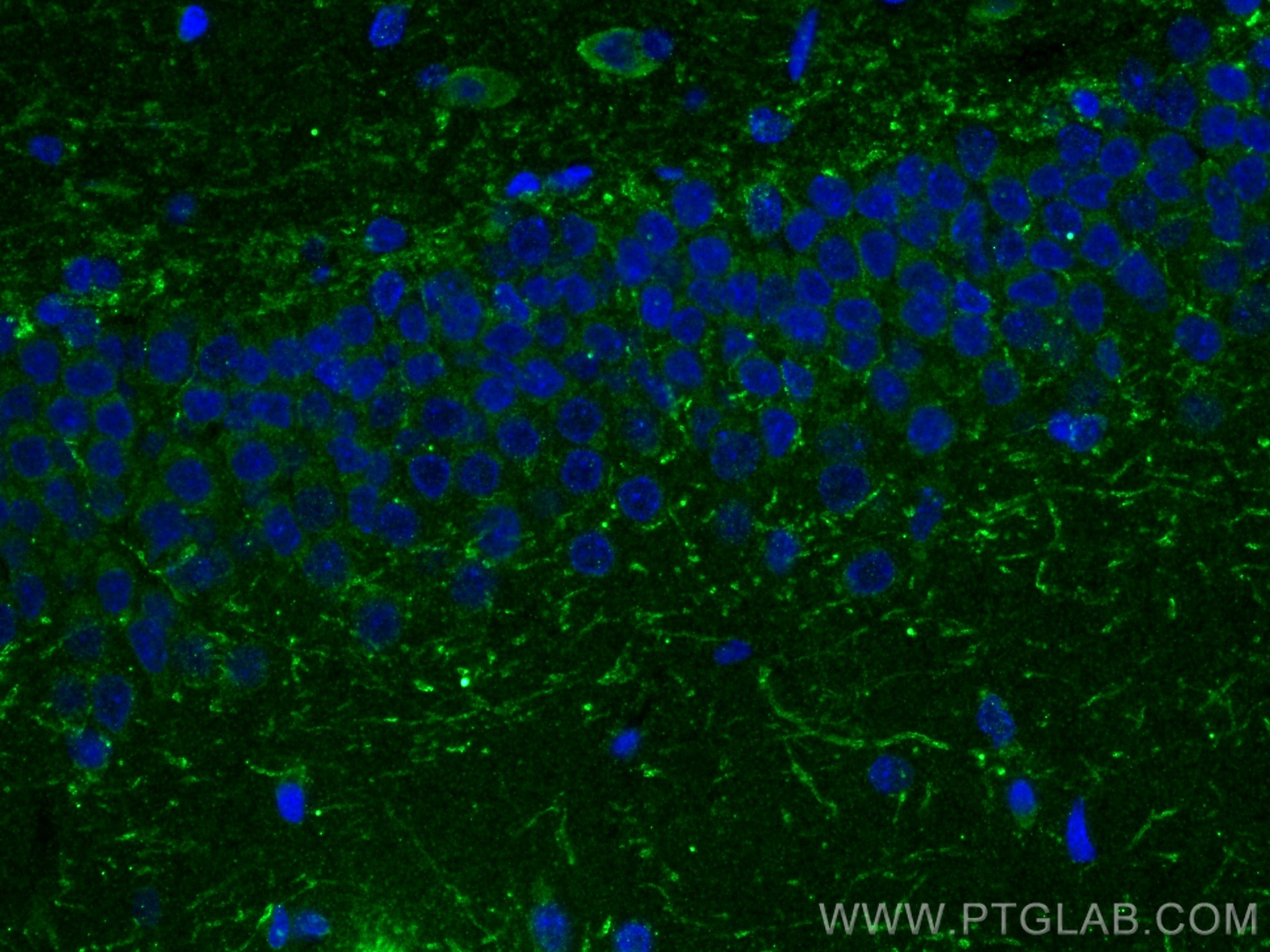 Immunofluorescence (IF) / fluorescent staining of rat brain tissue using HTR6 Polyclonal antibody (23561-1-AP)
