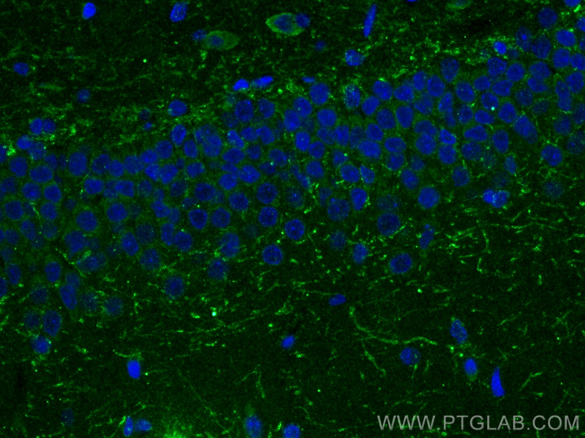 IF Staining of rat brain using 23561-1-AP